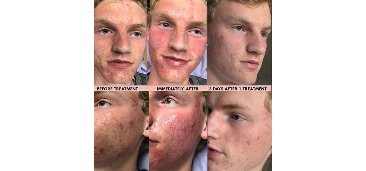 blemishes-1 (1)