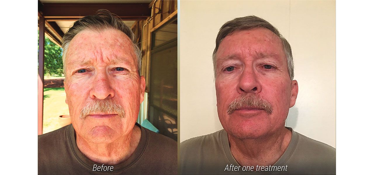 signs-of-aging-1