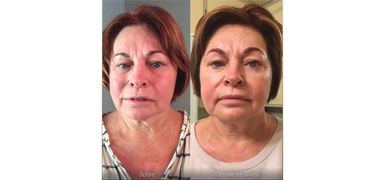 signs-of-aging-2